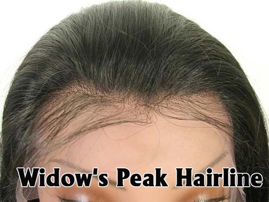 Widow's Peak hairline