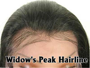 Widow's Peak hairline